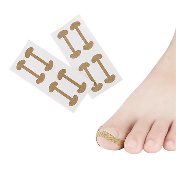 Toe finger on toenail groove embedded nail orthodontic device female toe roll nail patch quick pedicure deformable skin tone (4 patch/board)